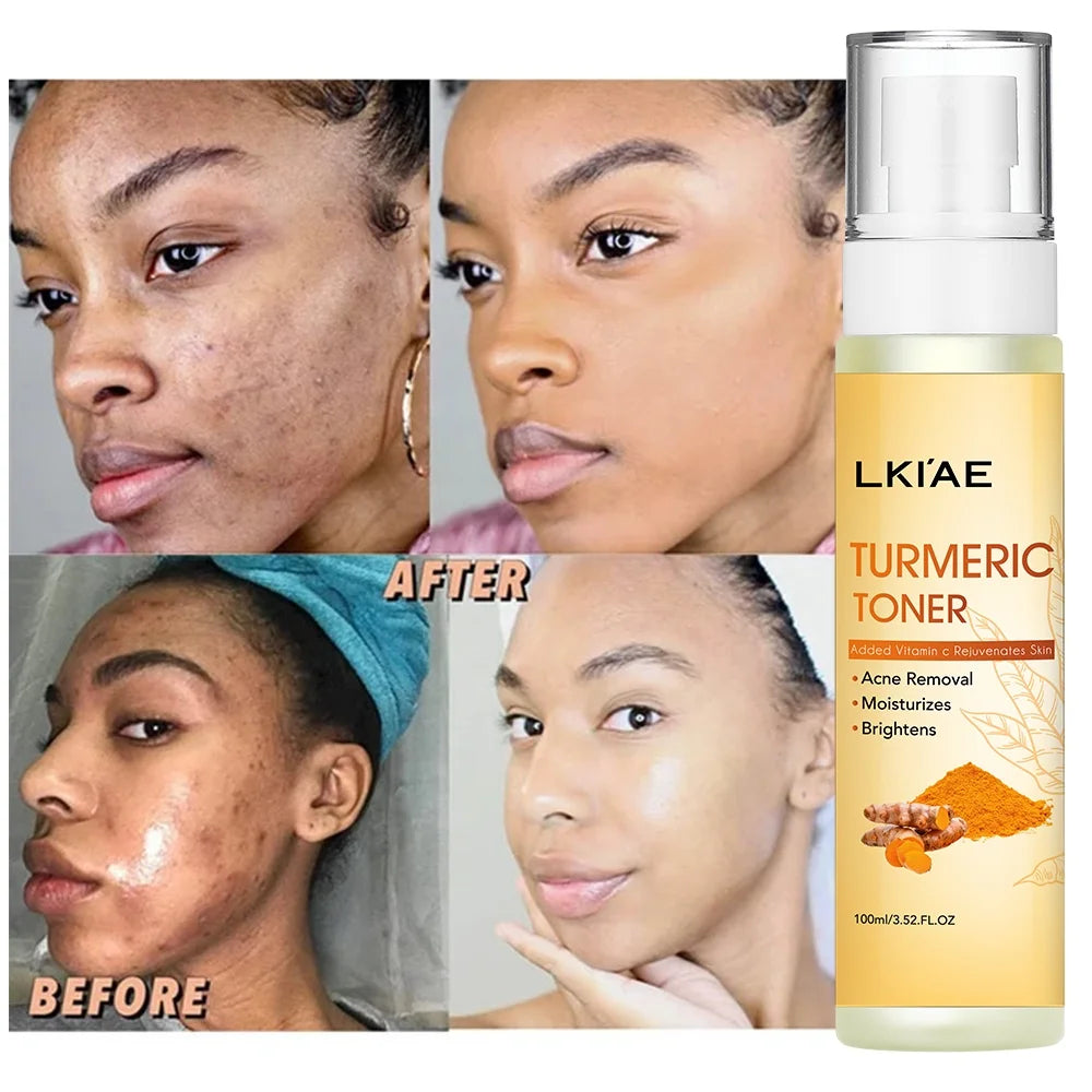 LKIAE Moisturizing Hydrating Face Rejuvenating Lightening Tumeric Natural Aloe Centella Beauty Makeup Toner for Skin