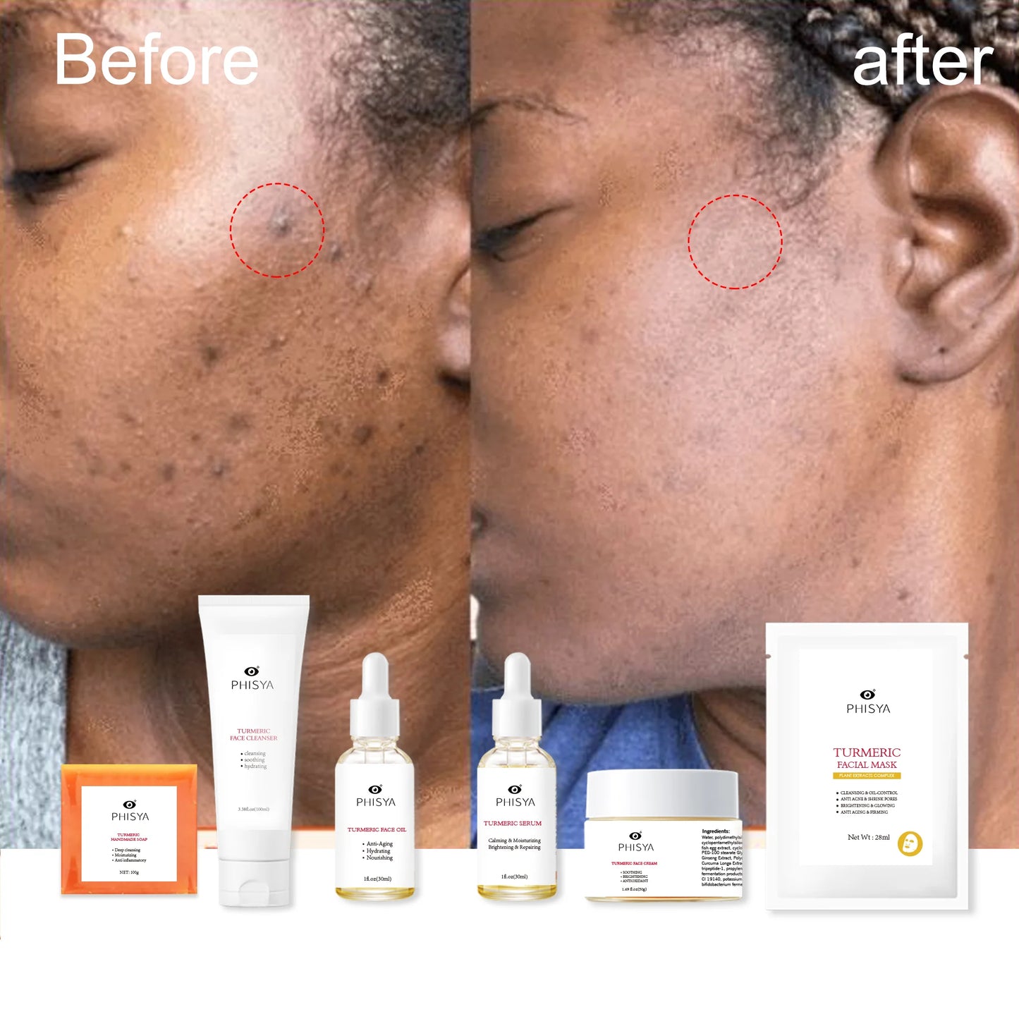 Private Label Tumeric Skin Care Products Anti Aging Anti Acne Moisturizing Facial Set Vitamin C Tumeric Skin Care Set