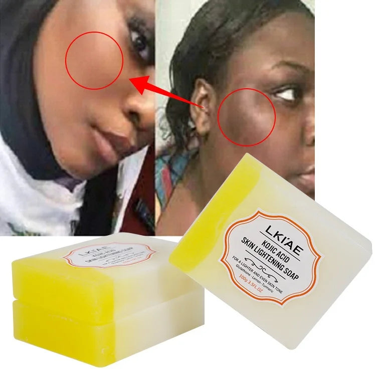 Wholesale Bar Soap 100G Gluthation Tumeric and Kojic Acid Organic Toilet Body Bleaching Skin Whitening Soaps for Bathing