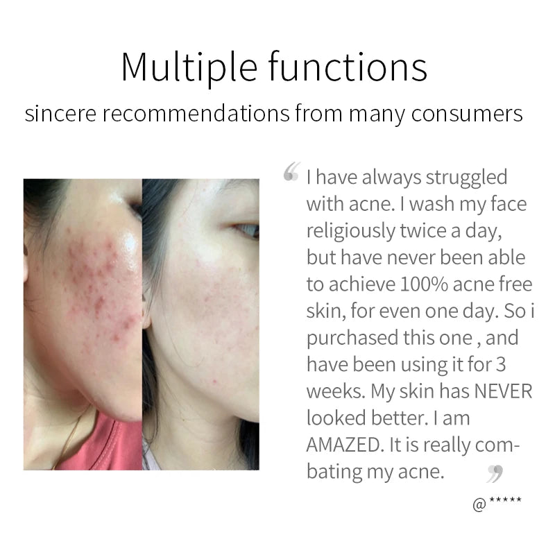 Custom logo Pure Vegan Organic Vitamin E Basic Cleaning Whitening Moisturizing Anti-oxidation Skin Care Herbal Tumeric Soap