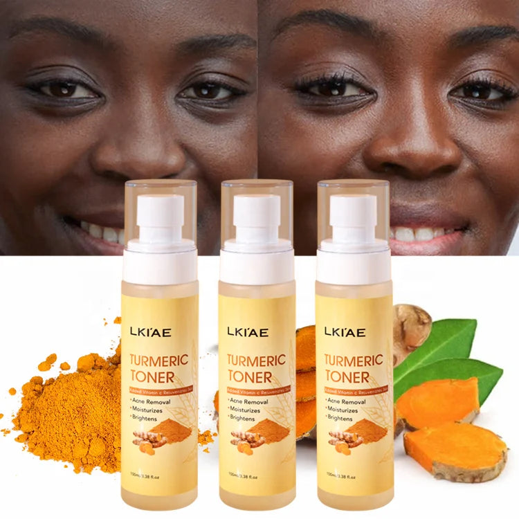 Ailke (New) Glowing Turmeric and Vitamine C Spray Acne Prone Moisturizing Tumeric Face Cosmetics Skin Toner for Oily