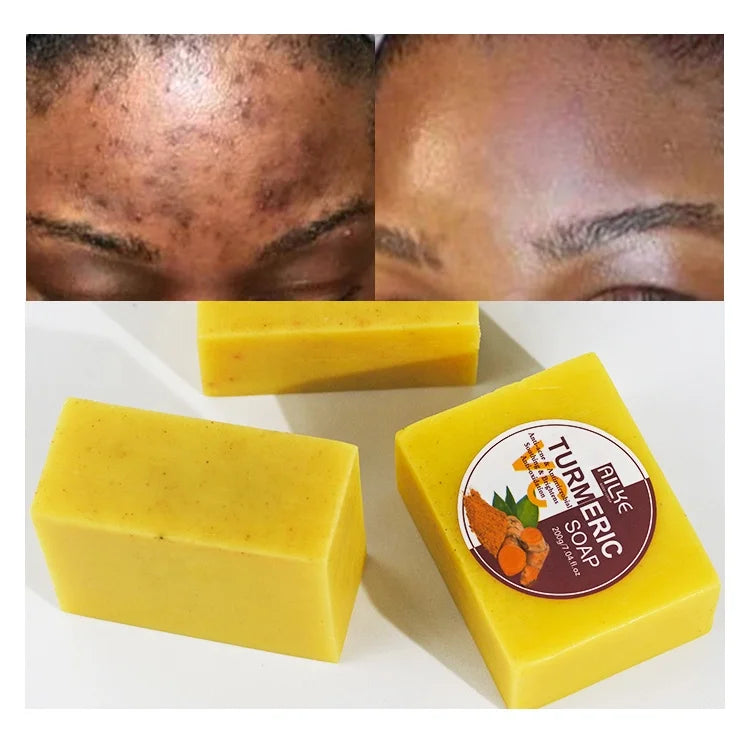 Custom Natural Organic Handmade Soap for Body Whitening Soap Bar AILKE Wholesale Hand Made Turmeric Tumeric Soap
