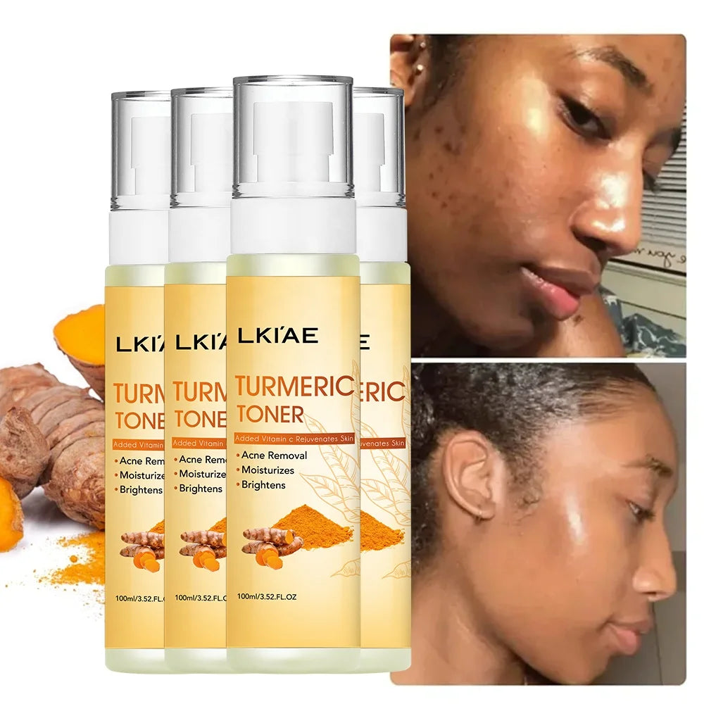 LKIAE Moisturizing Hydrating Face Rejuvenating Lightening Tumeric Natural Aloe Centella Beauty Makeup Toner for Skin