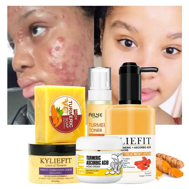 Ailke OEM Beauty Product Tumeric Skin Care Whitening Cream Set Anti Acne Brightening Skin Care Set