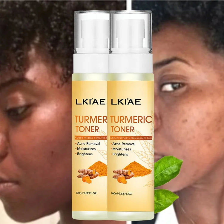 LKIAE Moisturizing Hydrating Face Rejuvenating Lightening Tumeric Natural Aloe Centella Beauty Makeup Toner for Skin